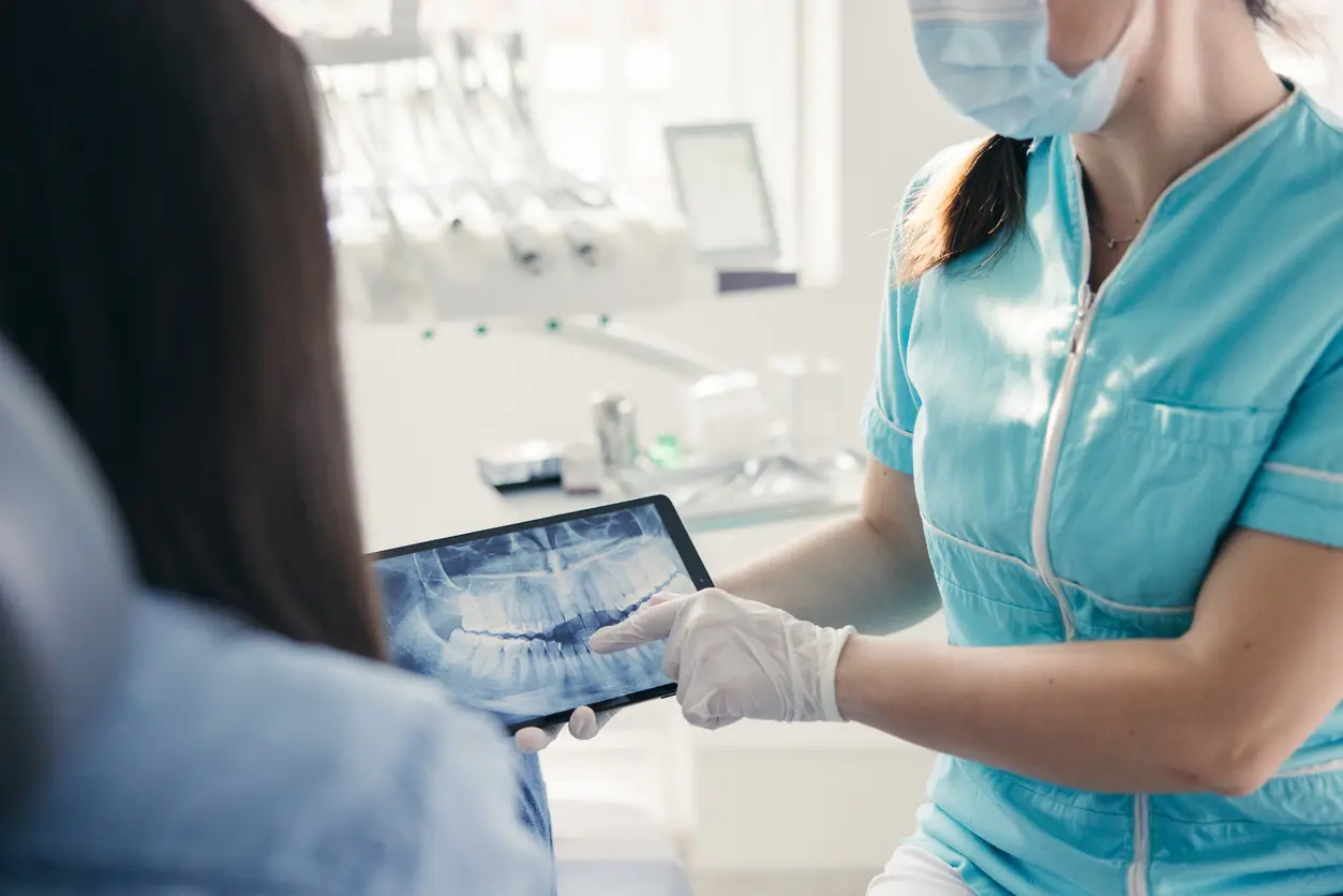 What Is Dental Crowding (or crowded teeth)?