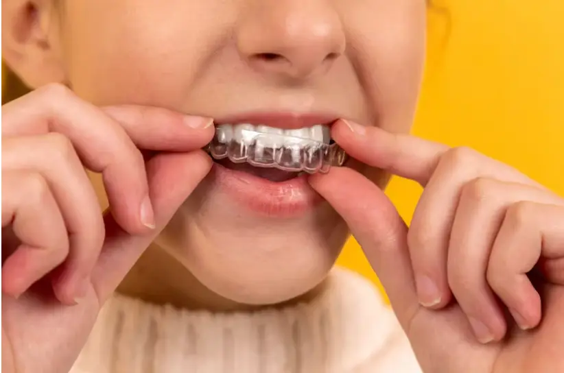 What to do if Your Teeth Have Moved After Wearing Braces?